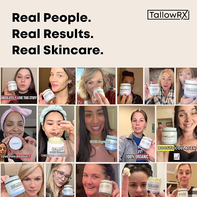 Tallow Body Lotion – 100% Grass-Fed Beef Tallow for Skin – Pure & Organic Moisturizer with Jojoba Oil & Vitamin E – Deep Hydration & Nourishment for Dry Skin (8 oz, Vanilla Scented)