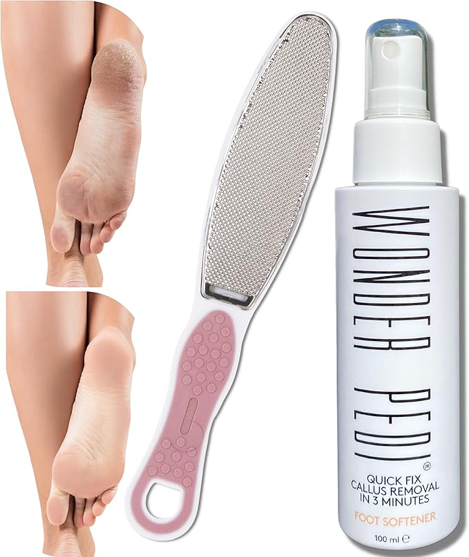 Made in Germany Double-Sided Metal and Emery Foot File - Heel Scraper & Cracked Feet Repair Instant Exfoliating Peel Foot Spray - Dead Skin Remover Cracked Heels Softener. Wonder Pedi