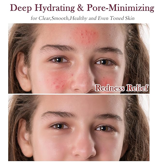 Skin Care Set Kit,Professional Pore Minimizer Soothe, Hydrate, Oil Control, Deep Cleanse Women Teen Girls Skincare Facial Skin Care Products,Travel Facial Skin Care Routine Kit Women Beauty Gift Set