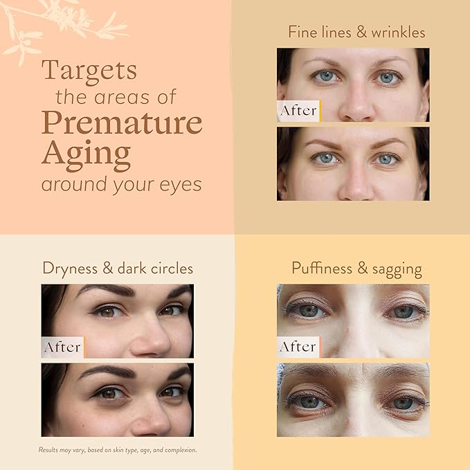 LILY SADO MILK+MANUKA™ Eye Repair Cream - Anti-Aging Natural Gentle Formula w/Coconut Milk, Manuka Honey, Sodium Hyaluronate & VITS C, B5 & E - Prevents Puffiness, Under-eye Wrinkles & Eye Bags - 1oz