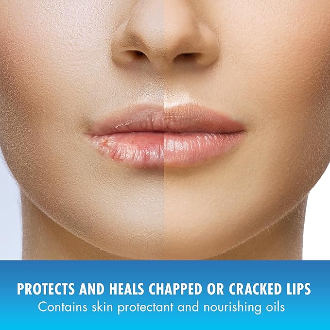 Natural Ice Cherry - SPF 15 lip balm, Cherry Flavor, 0.15 Ounce (Pack of 12)