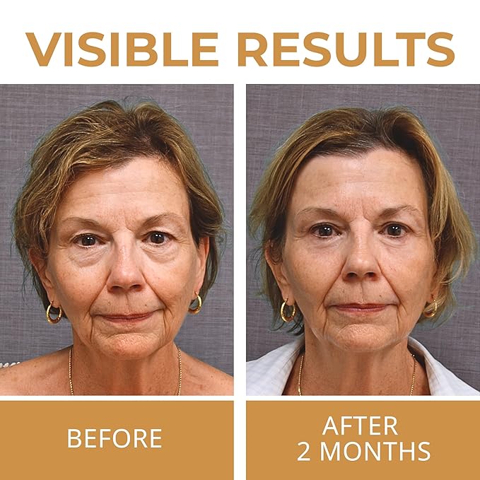 ABERA Natural Repair Eye Cream with Set 15 Eye Masks, Minimizes Under Eye Bags & Dark Circles, Reduce Puffiness, Wrinkles and Fine Lines, 0.5 fl oz