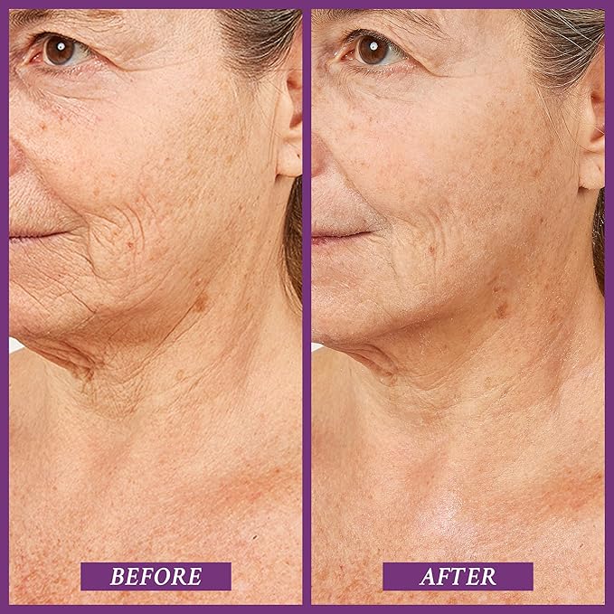 PRAI Beauty Ageless Throat & Decolletage Serum for Instantly Ageless Neck | Neck Firming and Tightening Serum | Anti-Aging Serum that Shields Skin from Damage and Improves Skin Tone + Colour | 4 Oz