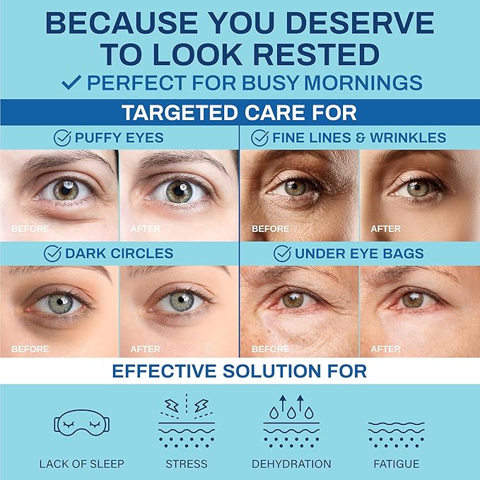 Under Eye Patches for Puffy Eyes and Dark Circles – Hydrating Eye Mask with Hyaluronic Acid Collagen & Caffeine – Skin Care for Women and Men 30 pairs