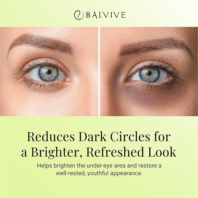 Eye Serum Treatment with Retinol, Caffeine & Multi-Peptides for Dark Circles, Puffiness, Wrinkles & Fine Lines - Hydrating & Revitalizing Under-Eye Cream for Women & Men, 30ml