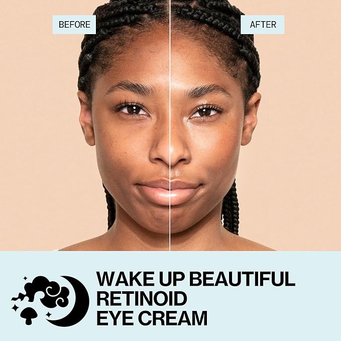 Pacifica Wake Up Beautiful Retinoid Eye Cream – Anti-Aging Under Eye Cream for Fine Lines & Wrinkles, Infused w/ Retinoid, Melatonin & Mushrooms for Puffiness, Dark Circles & Eye Bags Daily Treatment