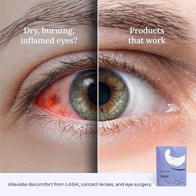 Rest: Self heating warm compress for dry eye | Heated eye Mask for fast relief | No microwave or washcloths needed | Travel ready | 90 counts