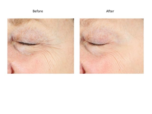 EyePlus+, a new formula powered by the ultimate trifecta of Methylene Blue, Ergothioneine, and Niacinamide. Dermatologist approved. Suitable for Sensitive Skin.