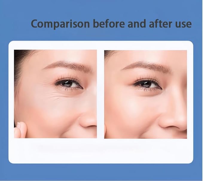 6 Pieces Silicone Eye Patches, Reusable Eye Wrinkle Patches For Dark Circles, Fine Lines, Wrinkles, And Puffiness.