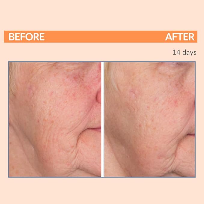 Serious Skincare - Vitamin C Day & Night Skin Care Set - Brightening Face Serum, Daytime SPF Moisturizer, Restore Night Cream, Face Wash - C3 C Esters for Hydrating, Fine Lines and Wrinkles (4Pack)