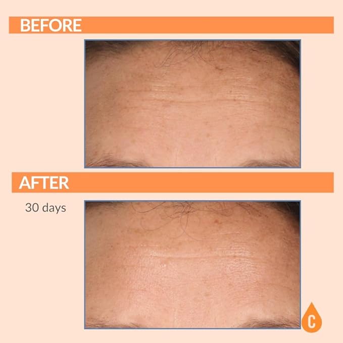 Serious Skincare Vitamin C & Collagen Skin Care Set - Reduce Wrinkles, Brightening - C-Restore Night Cream Moisturizer for Face, Eye Treatment Gel & C Clean Face Cleanser - Deep Hydration C3