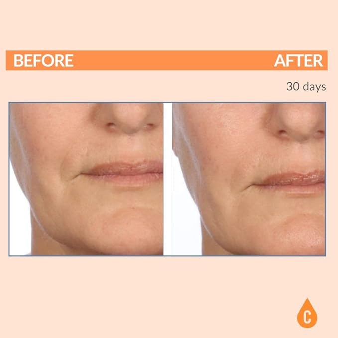 Serious Skincare - Serious-C3 Plasma Vitamin C Restore - Restoration Night Cream for Deep Hydration - Hydrolyzed Collagen - Hydrating Moisture for Face and Neck - 1.7 oz.