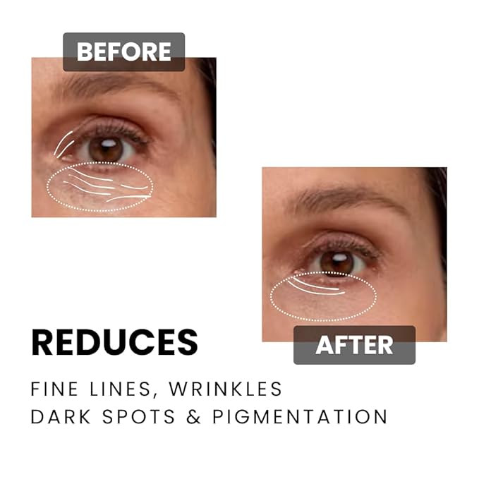 Anti-Aging Night Cream for Fine Lines, Wrinkles, Dark Spots, Pigmentation | Deep Hydration for Glowing, Youthful Skin | Suitable for oily, dry, and sensitive skin 3.52 oz