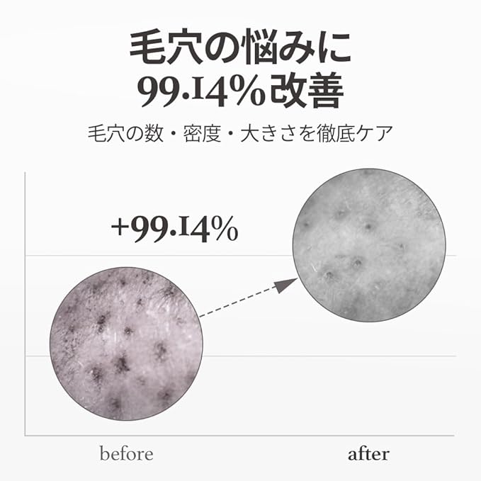 NOONI Facial Cleanser - Snow Aqua 0 LHA Toning Cleansing Oil *2ea | Makeup Blackhead Remover, Pore Control, Glass Skin, Help Control Sebum, Revitalizing, Moisturizing, Korean Skin Care, 6.76 Fl Oz x 2