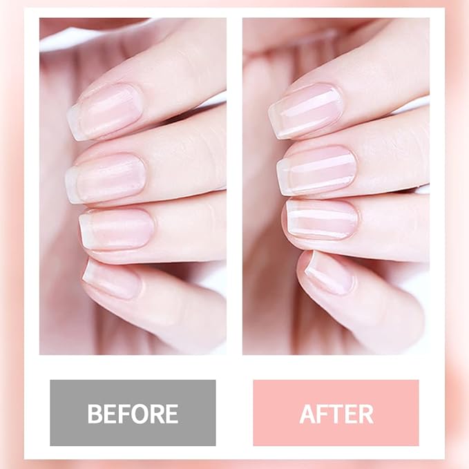 Nail Cuticle Oil Nail Nutrition Oil Pen Repair Nail Care Kit with Cutucle Oil