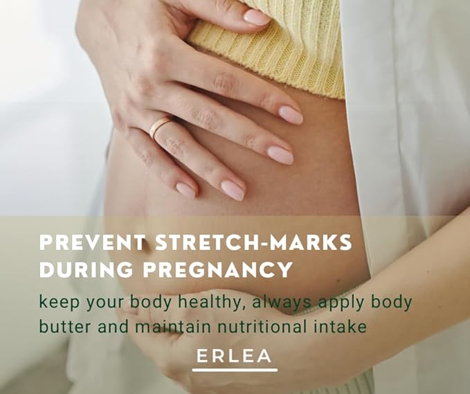 Erlea Coconut Body Butter 160 g/5.64 oz – Shea Butter, Body Butter for Women, Coconut Butter,Skin Care for Extremy Dry Skin, Organic Shea Butter, Body Care for Cracked Feet