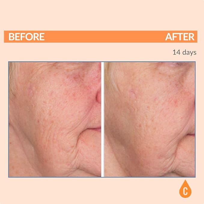 Serious Skincare - Serious-C3 Plasma Vitamin C Restore - Restoration Night Cream for Deep Hydration - Hydrolyzed Collagen - Hydrating Moisture for Face and Neck - 1.7 oz.