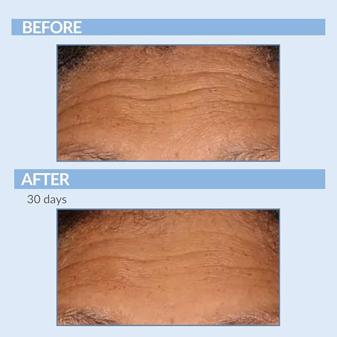 Vitamin A Force XR Retinol Serum Concentrate - Micro Exfoliate & Resurface for Radiant Skin - For Lines, Wrinkles - Pore Minimizer - Encapsulated Retinol for Anti-Aging - Serious Skincare - 1 Oz.