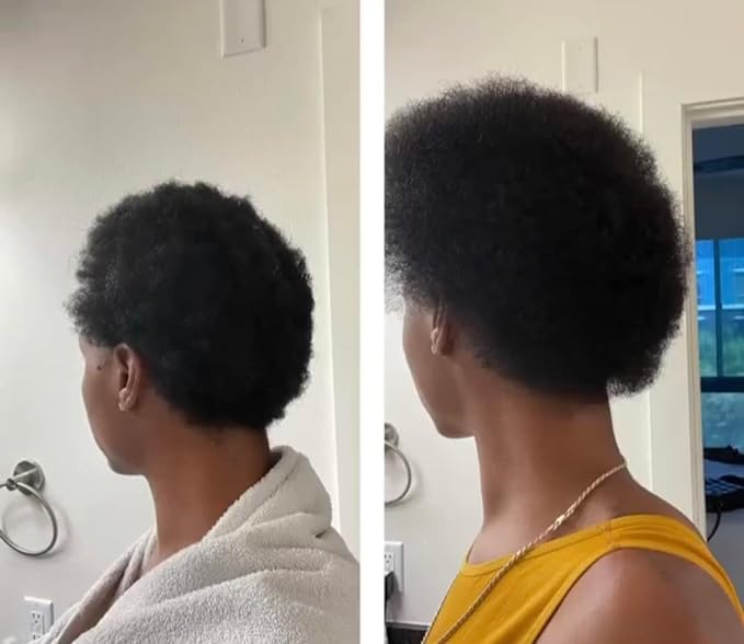 Growing Season Hair Growth And Repair Oil | With Burdock, Nettle Oil and Vitamin C for Visibly Fuller, Stronger and Shinier Hair.