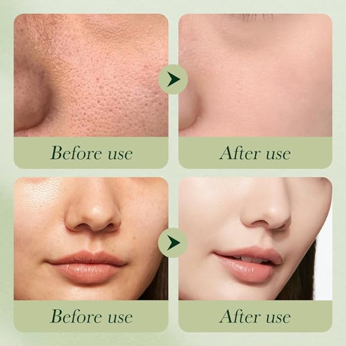 Avocado Skincare Sets,Skincare Gift Set with Facial Cleanser, Face Serum, Face Cream, Eye Cream, Toner, moisturizing Lotion, Anti Aging Skin Care Sets & Kits, Hydrating Facial Kit for women (6Pcs)