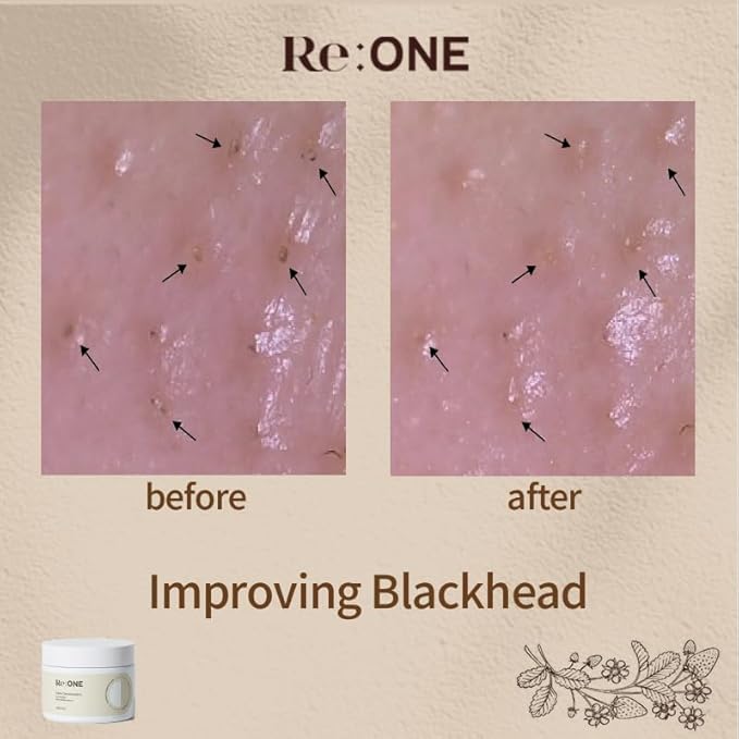 Re:ONE Strawberry Cleansing Balm, 6.7 oz (190 g) Blackheads Remover, Korean Makeup Cleanser, Korean Skin Care, Vegan Formula