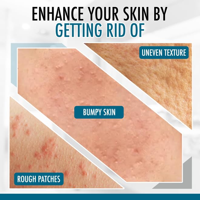 GLY MIRACLE Moisturizing Body Cream Lotion, 16 ounce - Non-Greasy Skin Humectant for Extremely Dry Skin, Hands, Body, and Feet, Light Fresh Scent with Pure Glycerin for Nourishing Hydration.