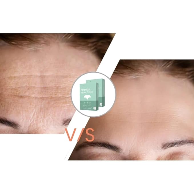 Forehead Wrinkle Patches - Reusable Silicone Pads for Forehead Lines & Frown Wrinkle Patches - Anti-Wrinkle Face Patches for Smoother, Firmer Skin - Overnight Wrinkle Treatment for Women & Men