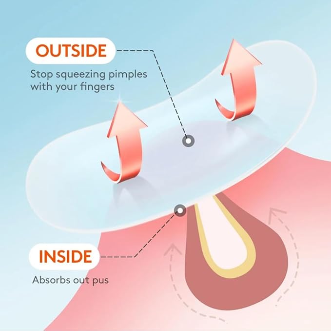ZitZap Pimple/Acne Patches For Face And Skin, Hydrocolloid Patches With Salicylic Acid And Tea Tree Oil For Covering Zits And Blemishes.