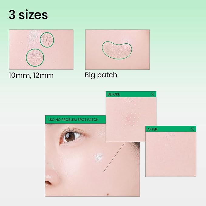 ilso No Problem Spot Patch, 72 Patches in 3 Sizes, Hydrocolloid Acne & Pimples Patches with Hyaluronic Acid and Niacinamide to reduce acne, White dots absorbed, Korean Skincare