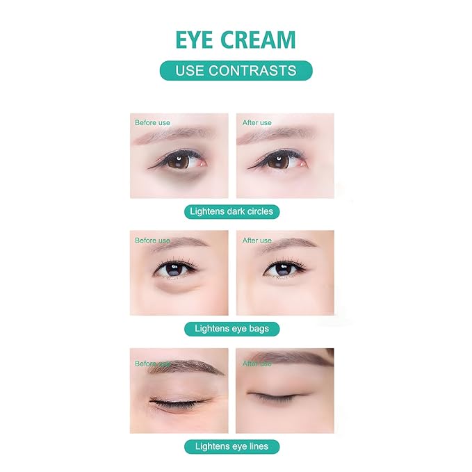 Caffeine Eye Cream, 2.5% Activity Retinol Eye Cream For Puffiness And Bags Under The Eyes Deep Moisturizing Anti-Wrinkle Aging Fine Line,1.05 Oz