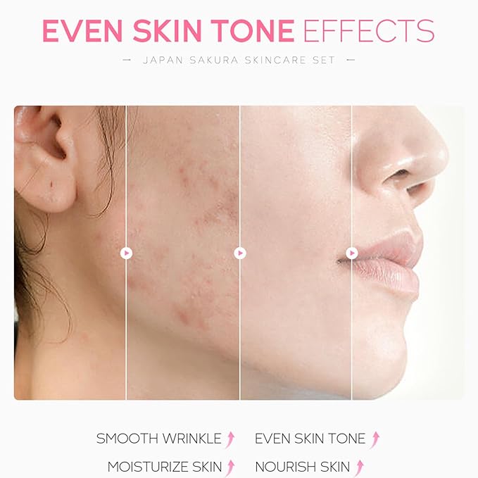 6 Pcs Skin Care Sets JAPAN SAKURA Women Beauty Gift Sets Sakura Skin Care Kit with Cleanser, Toner, Serum, Eye Cream, Lotion, Essence Cream Travel Kit for Women Teen Girls