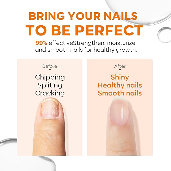 modelones Cuticle Oil and Nail strengthener, 15ml Nail & Cuticle Care Strengthener Oil Vitamin E + B Cuticle Revitalizing Oil for Nail Growth and Gel Nail Polish