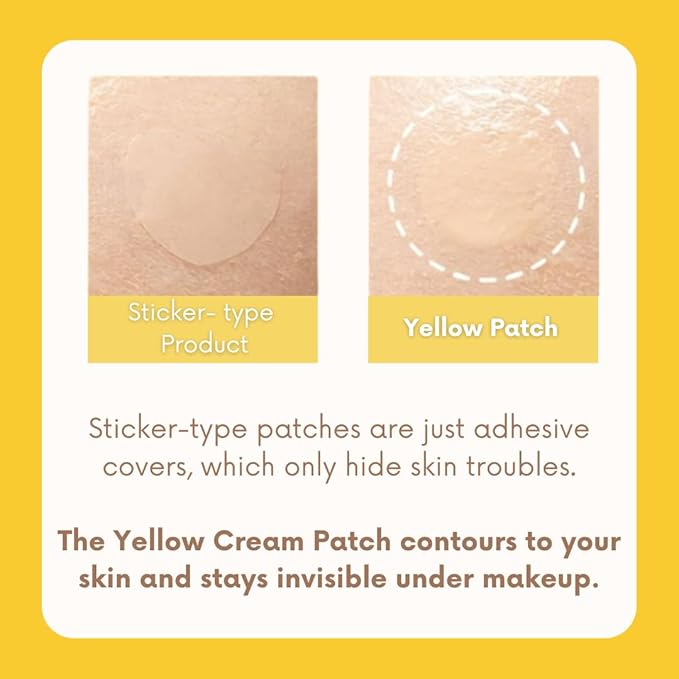 Yellow Cream Patch | Proactive Spot Care with Sulfur and BHA, Salicylic Acid Blemish Care, Cream to Patch Formula, Makeup-Friendly, Hydrating & Soothing, Korean Skincare, 0.67 fl oz.
