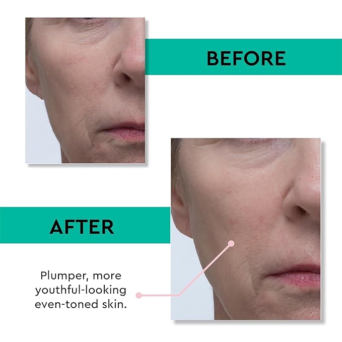 Clark's Botanicals Retinol Rescue Overnight Cream: Hyaluronic Acid & Patented Vitamin C, All Skin Types, Patented Time-Release Retinol, 30ml | 1oz