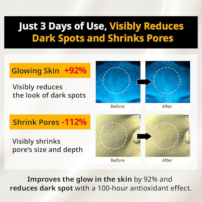 PRIMERA (PRMR) 𝐘𝐨𝐮𝐭𝐡 𝐑𝐚𝐝𝐢𝐚𝐧𝐜𝐞 𝐕𝐢𝐭𝐚𝐭𝐢𝐧𝐨𝐥 𝐒𝐞𝐫𝐮𝐦 - Retinol with Vitamin C Bundle SET VitaminC, Korean Skin Care, Moisturizing, Shiny, Elastic, Lifting, 0.7 oz (21 g *2)