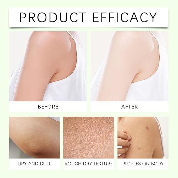 Neuropathy Mama Oasis Lotion,Neuropathy Magnesium Cream For Neuropathy Magnesium Body Butter Deeply Moisturizes Skin, Neuropathy Cream Magnesium,Keep Soft Smooth.