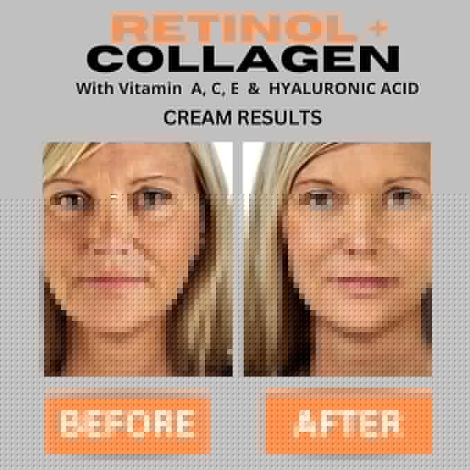 Retinol + Collagen, Hyaluronic Acid, Vitamin C Anti-Aging Face Cream, Day and Night Moisturizing Cream, Anti-Wrinkle Cream for Face, Firming Cream - 4oz