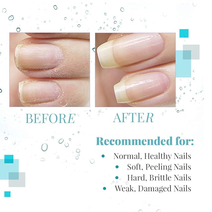 Nail Tek Renew Cuticle Oil for Nails - Natural Nail Care with Tea Tree Oil - Hydrates and Restores Soft, Healthy Cuticles, For All Nail Types, 14.3 mL