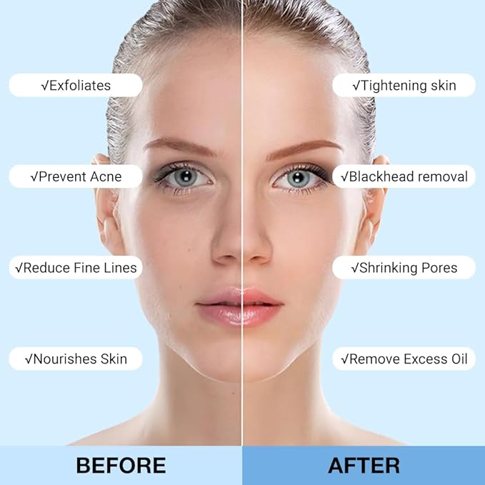 Clay Mask For Face, Vitamin C Face Masks with Turmeric and Kaolin Clay, Deep Cleansing Pores, Skincare Facial Mask for Refining Pores and Controlling Oil, (Blueberry)