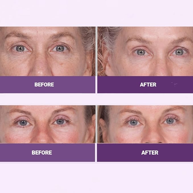 INSTA-TOX Facial Firming Wrinkle Smoothing Serum & Reverse Lift Firming Eye Cream Set - Tightener for Lines, Deep Wrinkles and Pores - Temporary Lift for Face and Eyes - Serious Skincare