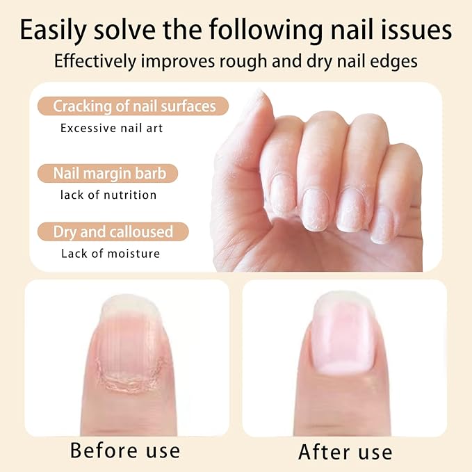 Nail Cuticle Oil KIT 2 Scent (Strawberries Peaches) Revitalize and Strengthen Your Nails Premium Nail Nutrient Oils Ideal for Home DIY or Nail Salon.