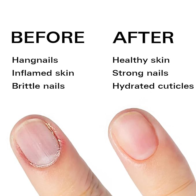 Nail Oil Cuticle Pen - Rose – Nail Strengthener & Growth Serum with Vitamin A, D, E, B5, Grapeseed & Natural Oils – Repair for Brittle, Peeling, Thin Nails – Twist Brush Pen