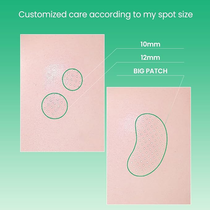 ilso No Problem Spot Patch, 72 Patches in 3 Sizes, Hydrocolloid Acne & Pimples Patches with Hyaluronic Acid and Niacinamide to reduce acne, White dots absorbed, Korean Skincare