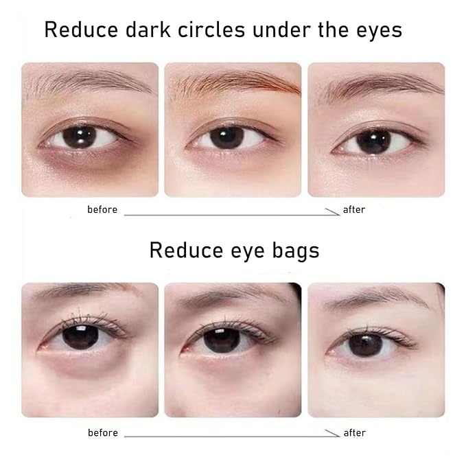 Eye Bag Remover Glasses,Revital Eyes Red Light Glasses, Revital Eyes Red Light Glasses, Eye Beauty Glasses Eyes Bag Remover For Reduce Dark Circles And Wrinkles At Home, One Size