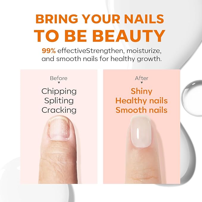 modelones Nail Strengthener, Milky White Nail Natural Concealer Foundation Polish Air Dry Nail Growth Polish for Damaged Nails Imperfection Masking Gifts for Women 15ml