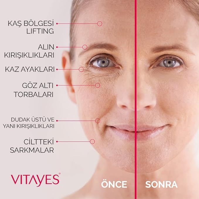 VITAYES Instant Ageback Lifting Cream, Dark Circle Bags Under Eye Remover, Anti Wrinkle and Fine Lines Face Lift Cream 0.52 Oz