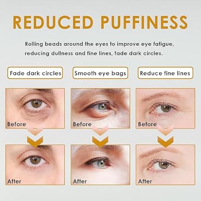 SWANNA 1PCS Eye Essence Oil Roller Ball Applicator, Castor Oil Frankincense Rollerball, Rollerball Castor Oil for Eyes,Dark Circles, Reduce Swelling and Fine Lines