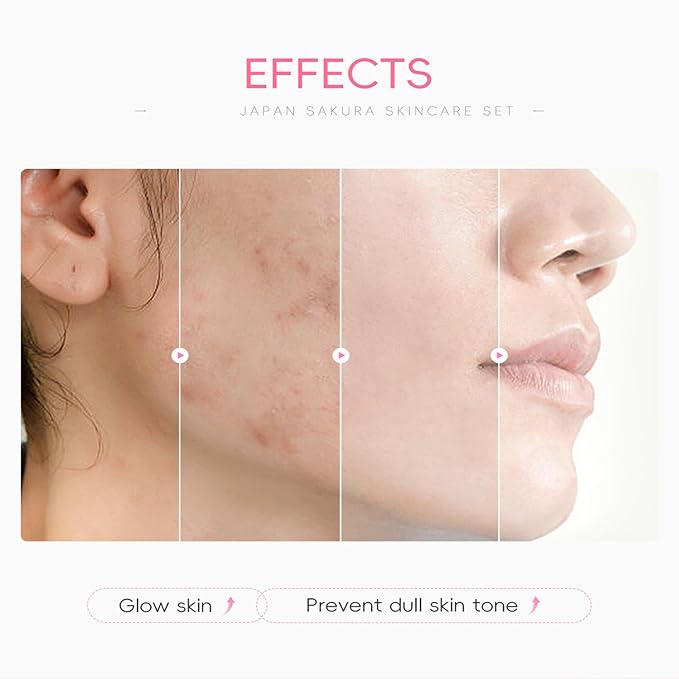 Skin Care Set with Cute Mini Luggage,Sakura Skin Care Sets & Kits,Pamper Sets For Teenagers Girls Gifts,Skin Care Set For Teenagers Girls 10-12 (One Size, Cherry Blossom-StyleC-Advanced Moisturizing)