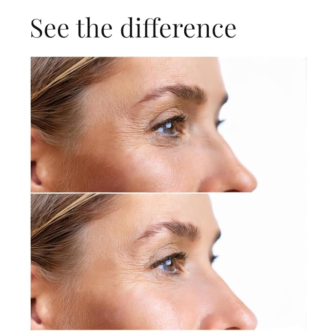 Dark circles under eye treatment | Eye Cream Anti Aging. Formulated for Dark Circles, Bags under the Eyes and Reducing Wrinkles.