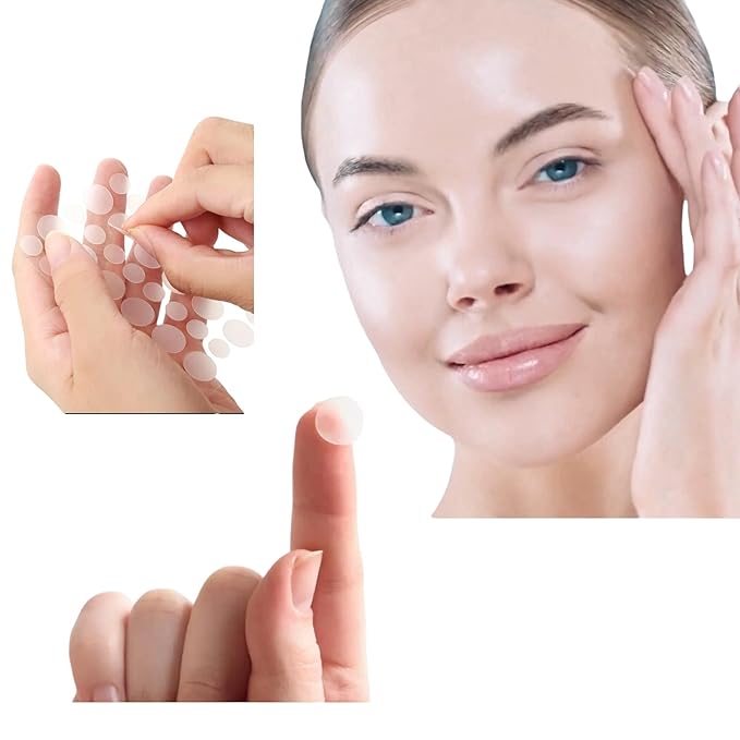 ZitZap Pimple/Acne Patches For Face And Skin, Hydrocolloid Patches With Salicylic Acid And Tea Tree Oil For Covering Zits And Blemishes.